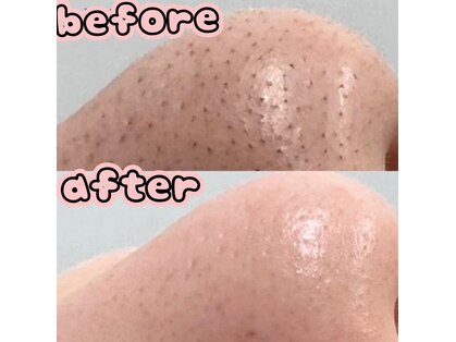 アベイユ(Abeille)の写真