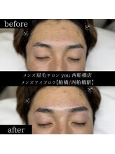 ユー 西船橋店(you)/ビフォーアフター写真