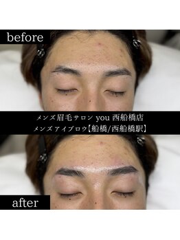 ユー 西船橋店(you)/ビフォーアフター写真