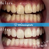 ホワイトニングカフェ 吉祥寺店(WhiteningCafe)