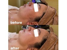 オーシャン(OCEAN)/リリースカッターフェイシャル