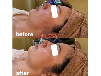 オーシャン(OCEAN)/リリースカッターフェイシャル