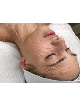 シミしわ改善！予防ケア