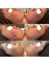 アネル 宮古島店(anel)/