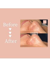 クリアラボ 豊中(Clear Lab)/Before&After