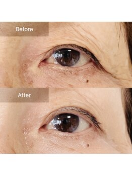 ウツクシ 三軒茶屋(UTUKUSHI)/before→after　