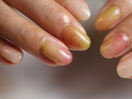 いちじく/柳津ネイルサロン