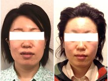 ウェリナ平和堂長久手院/小顔矯正/骨盤矯正/痩身/整体