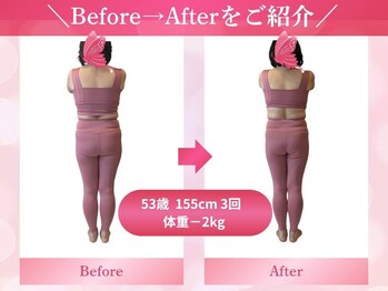 キュートレ 東日本橋 人形町店(Cuetre)/【ビフォアフ8】53歳 3回