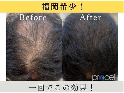 ウィズサロン 天神大名店(withサロン)の写真