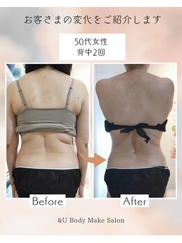 アンドユー(&U)/