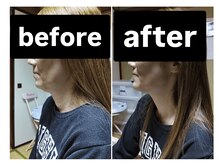 もみほぐし整体 十姉妹商店 長橋店/リフトアップ