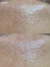 グリーン(green)/全顔取り放題♪