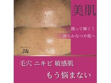 ファミリータイズカンパニーガデス(Family Ties Co. Goddess)の雰囲気（本気のニキビ改善【ニキビ/毛穴/ピーリング】）