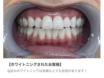 ビアンカ 小田原店(BIANCA)/