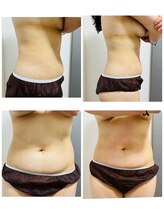 ナチュラルビューティラテ(NATURAL BEAUTY LATTE)/キャビリポ