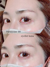 アネラ(ANERA)/パリジェンヌ