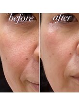 プレシャスサロン(precious salon)/40代女性　Before＆After