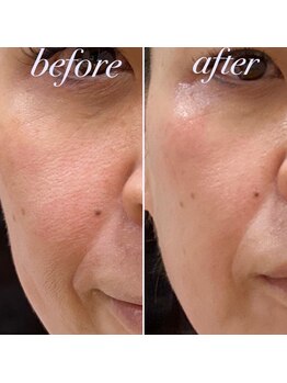 プレシャスサロン(precious salon)/40代女性 Before&After