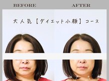 こゆびヒメ 市川駅前店の雰囲気（今まで結果に満足できなかった方一度ご相談下さい♪　小顔専門店）
