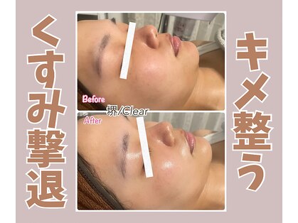 クリア(Clear)の写真