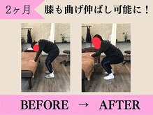 やさしい整体院 神辺店/膝の曲げ伸ばしが可能に！