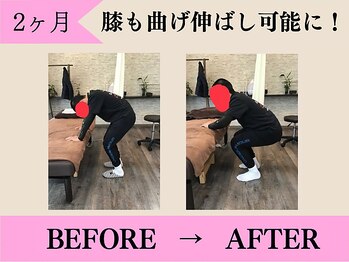 やさしい整体院 神辺店/膝の曲げ伸ばしが可能に！
