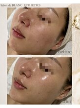 サロン ド ブラン アオヤマ(Salon de BLANC AOYAMA)/