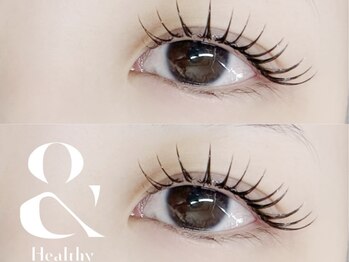 アイアンドネイル ブライト(bright)/アンドヘルシー