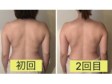 全身トリートメントで皮膚、筋肉、骨格、内臓までアプローチ