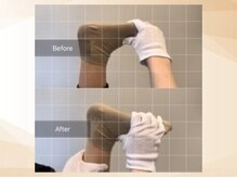 エモア メディカル整体院 恵比寿院(Emoa)/【30代女性】下肢の症状