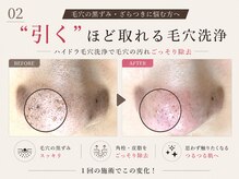 ピアリーノ(Pialino)