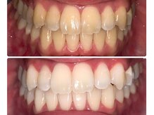 パールプラス 小牧店(Pearl plus)/BeforeAfter