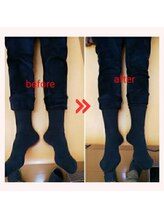 美藤鍼灸院/骨盤矯正のBefore After