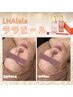 【都度】LHALALAララピール(全顔/首)×艶玉アイドルゲルパック