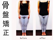 練馬アカデミア美容整体院/産後骨盤矯正　痩身　マタニティ