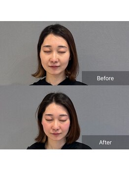 プライミー(PRIMY)/写真写りが劇的変化