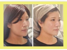 アン 銀座(ann)/レモンボトルでリフレッシュ