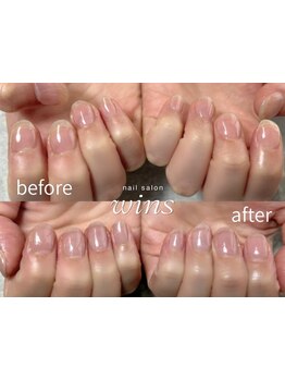 爪の悩みを解消できる（ケア含む）