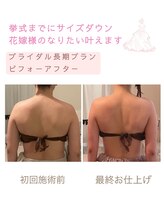 ティアラ(Tiara)/