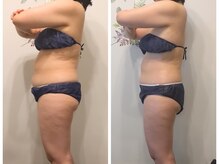 ニコルビー(Nicole Bee)/