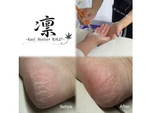 凛-NailAtelier RIN27-の雰囲気（パラフィンパックや角質除去のメニューもございます(^^)）