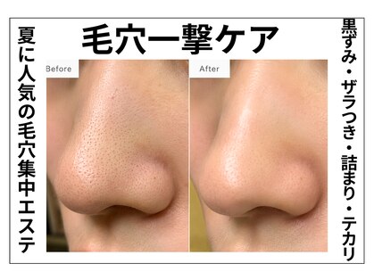 ミニマム(minimum)の写真