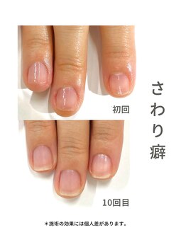 最強ネイルケア