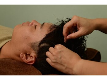 シン(SHINE)/美容鍼灸 頭皮鍼