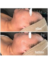 ミニョン(mignon)/エイジングケアしてますか？