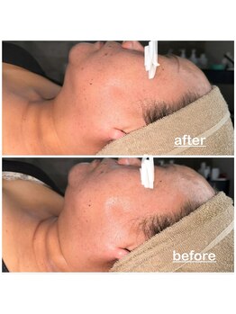 ミニョン(mignon)/エイジングケアしてますか？