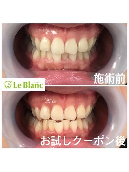 ルブラン 奈良店(Le Blanc)/一生モノ！！