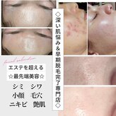 リアン(Lien)