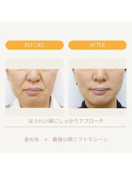 ムーンライズ(moonrise)/